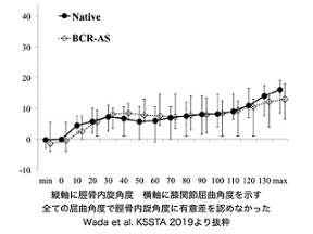 健常膝関節の動きを再現した人工膝関節置換術の開発 - 国立大学