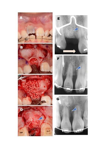 ▲矯正治療への対応例。
