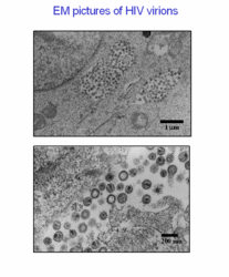 Em picture of HIV virions